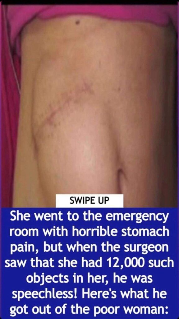 She went to the emergency room with a horrible stomach pain